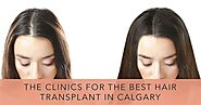 The 7 Clinics for the Best Hair Transplant in Calgary [2021 ]