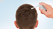 Hair Restoration | du Brule Hair Clinic | Calgary & Edmonton, Alberta