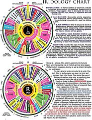 Iridology Near Me - Philadelphia Holistic Clinic - Dr. Tsan and Associates