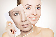Some Common Anti Aging Treatments to Look For