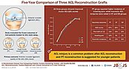 Study highlights importance of ACL reconstruction for youth at high risk of knee reinjury | Calgary