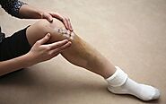 Your Injury Knee - Banff Sport Medicine