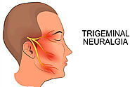 Advanced Technologies For The Trigeminal Neuralgia Treatment In Jaipur