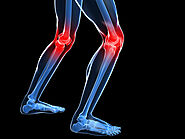 Private Knee Arthroscopy in calgary | Clearpoint Health
