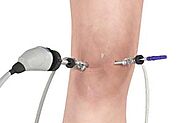 Physiotherapy in Calgary for Knee Surgery