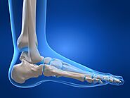 Calgary Foot & Ankle Surgery - Alpine Foot & Ankle Clinic