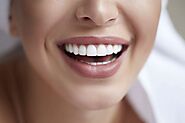 Teeth Whitening: Aspects, Process And Results