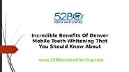 Incredible Benefits Of Denver Mobile Teeth Whitening That You Should Know About