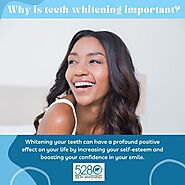 Achieve a Radiant Smile with Denver Mobile Teeth Whitening Service by 5280 Teeth Whitening