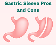 Gastric Sleeve Surgery: Pros and Cons (Everything you need to know)