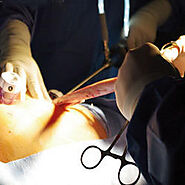 Sleeve Gastric Surgery in India