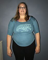 Weight Loss Patient Stories Photos | Obesity Control Center