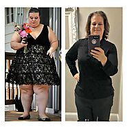 Kimberly celebrates 215-pound weight loss after gastric sleeve bariatric surgery — Prime Surgicare