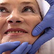 Facelift Langley | Estheticon.com