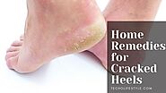 Website at https://www.techolifestyle.com/2021/11/home-remedies-for-cracked-heels.html