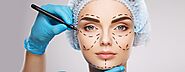 Mini Facelift in Tijuana Mexico - Plastic Surgery - LIMARP Clinic