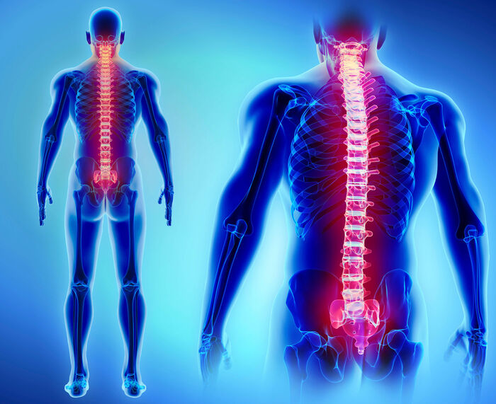 Spinal Disc Replacement Surgery In Calgary A Listly List