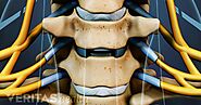 Spine Assessment Clinic | Alberta Health Services
