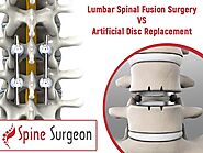 Artificial Disc Replacement | Spine Surgeon