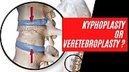 Vertebroplasty and Kyphoplasty Surgery In Calgary