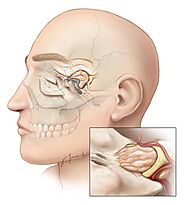 Comparison of Surgical Approach to Endoscopic Pituitary Adenoma Resection