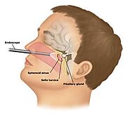 Endoscopic endonasal surgery