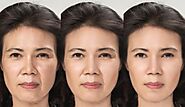 Face & Neck Lift Surgery - Sydney Cosmetic & Plastic Surgery Clinic