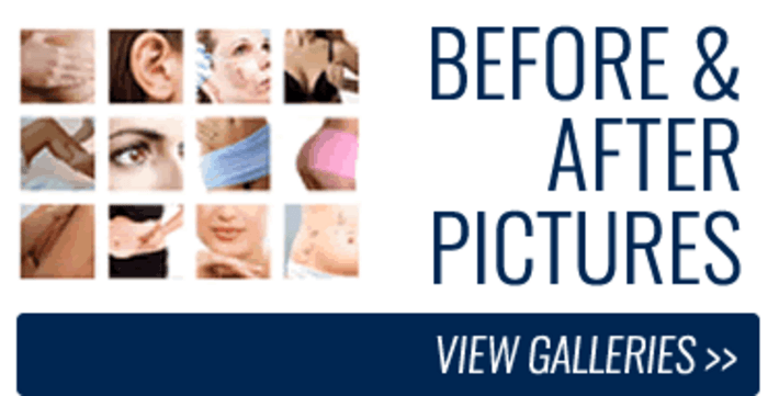 Fat Injection Sydney A Listly List