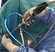 Urological Surgery - Prostate Cancer & Kidney Stones