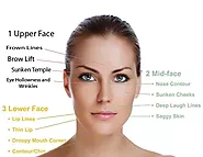 Mini Facelift in Tijuana Mexico - Plastic Surgery - LIMARP Clinic