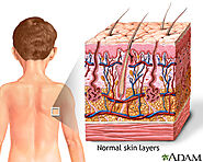 Skin lesion biopsy | Calgary Herald