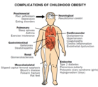 Complications of Childhood Obesity
