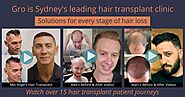 Gro Sydney hair loss clinic offers solutions for EVERY stage of hair loss including Sydney's most refined hair transp...