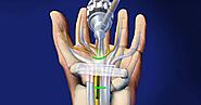 Dr Ian Yuen Hand & Wrist Surgeon Sydney – Sydney Hand & Wrist Surgery Practice for Dr Ian Yuen