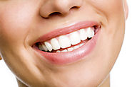 Benefits of Professional Teeth Whitening