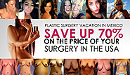 PRICE LIST | SAVE UP TO 70% - Plastic Surgery Packages in Mexico City