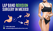 Gastric Lap Band Revision Surgery in Mexico | Jet Medical Tourism