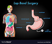 Louisiana Valenzuela Bariatric Surgeon MD - Overview