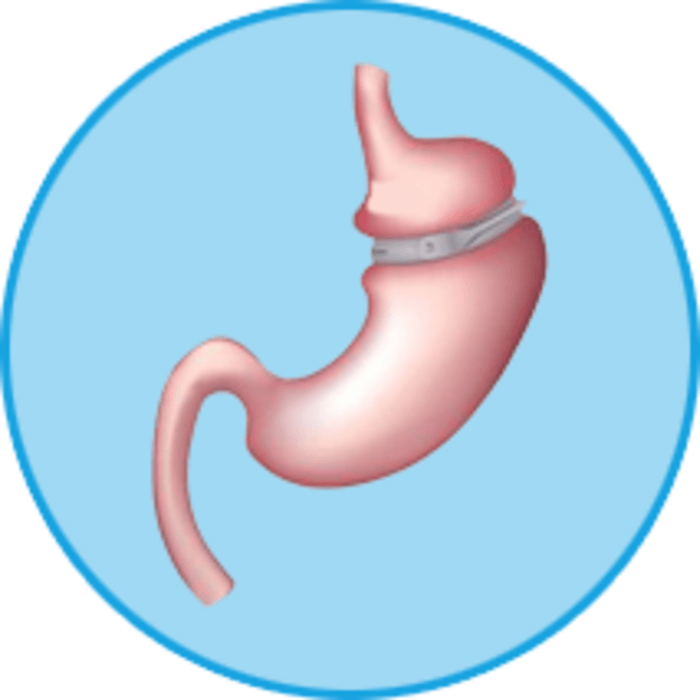 Lap Band Surgery in Chihuahua A Listly List