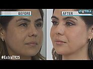 How to Get a Quick Face-Lift Without Surgery