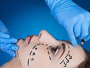 Facelift: What to expect and possible complications