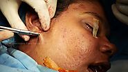 Facelift Plastic Surgery, Cosmetic Rhinoplasty | Dr. Sunil Richardson