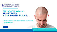 Best Hair Transplantation in Coimbatore
