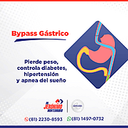 Gastric Bypass Monterrey : Dr. Jeronimo Monterrubio