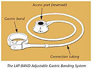 Descripción: Perioperative communication from the perspective of patients undergoing bariatric surgery