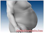 Gastric Bypass Surgery Cost | RNY Bypass in Puerto Vallarta