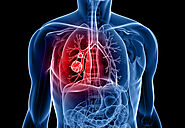 How Covid-19 Affects your Lungs | COVID-19 Lung Damage