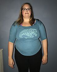 Weight Loss & Bariatric Surgery | Obesity Control Center
