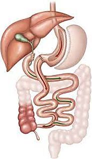 Affordable Duodenal Switch Surgery in Tijuana by an Expert Surgeon