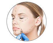 Facelift Melbourne | Rhytidectomy Victoria